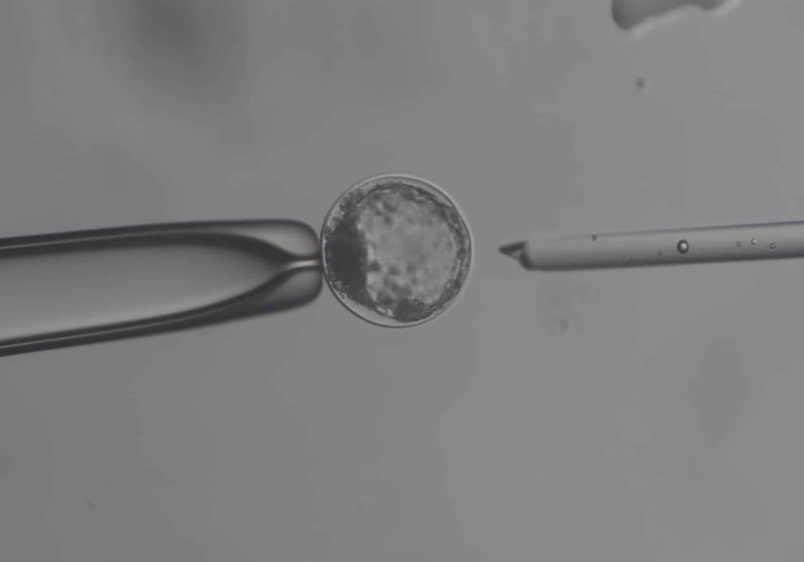 CameraAdapter: 0.5x / MicroscopeName: Axiocam208 CameraAdapter: 0.5x / MicroscopeName: Axiocam208
