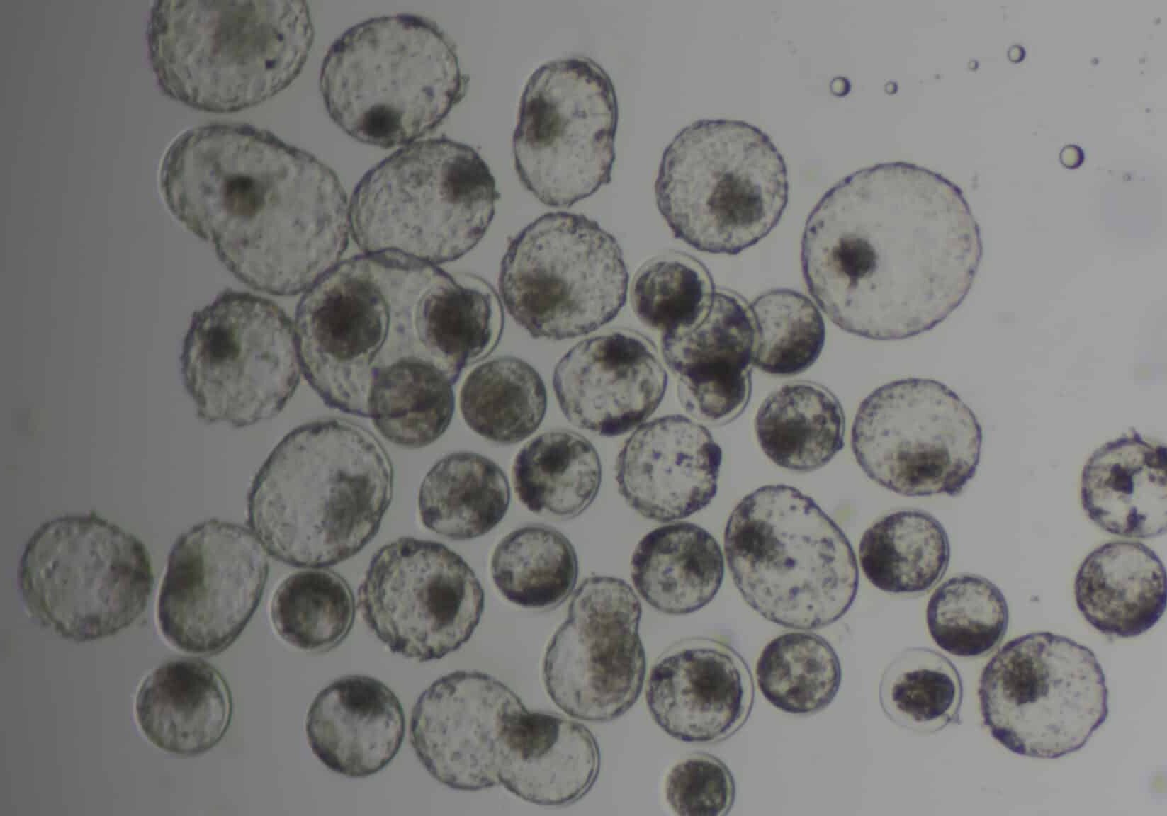 CameraAdapter: 0.5x / MicroscopeName: Axiocam208 CameraAdapter: 0.5x / MicroscopeName: Axiocam208